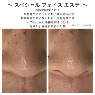 マツエク・マツパ ビューティー ミロワールのエステ・リラクイメージ