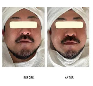 grow所属・Yoshino Erinaのエステ・リラクイメージ