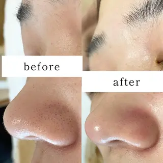 毛穴専門サロン　フルール所属・フルールFululu 自由が丘のエステ・リラクイメージ