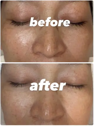 POLA THE BEAUTY 堺東店所属・肌管理🌿毛穴改善 POLA堺東のエステ・リラクイメージ