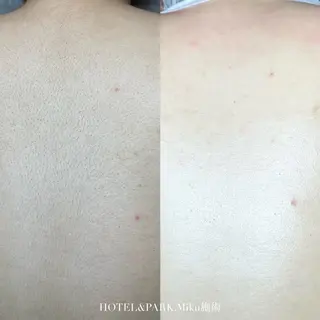 HOTEL&PARK Mikuワックス脱毛のエステ・リラクイメージ