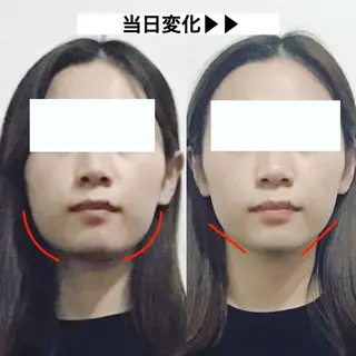 顔の歪み矯正専門 宮内翔のエステ・リラクイメージ