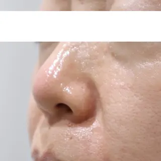 毛穴に特化したサロン MYFAIRLADYのエステ・リラクイメージ