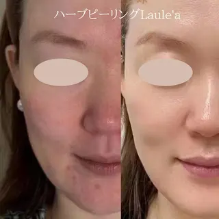 美腸サロン🌺 腸もみ/小顔/リンパのエステ・リラクイメージ