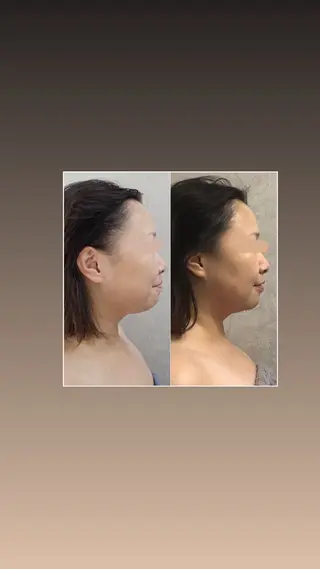 Chio-RE所属・Wax/絹肌艶肌🌼 坂結加のエステ・リラクイメージ