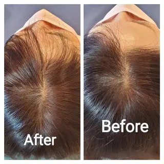 歯科提携セルフダック 宇都宮駒生店のエステ・リラクイメージ