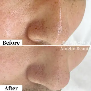 毛穴ケア専門サロン Amélio Beauté所属・毛穴ケア専門サロン アメリオボーテのその他イメージ