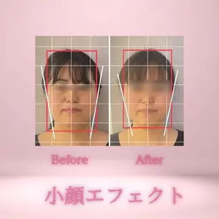 小顔・肌悩み専門店 ボーテドリッシュのエステ・リラクイメージ