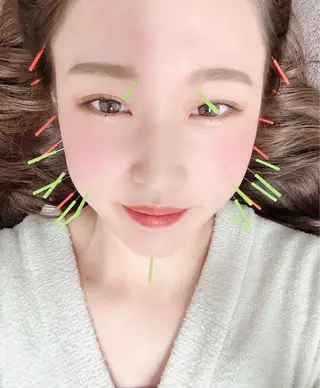 美容鍼・小顔矯正 ハリシェンドのエステ・リラクイメージ