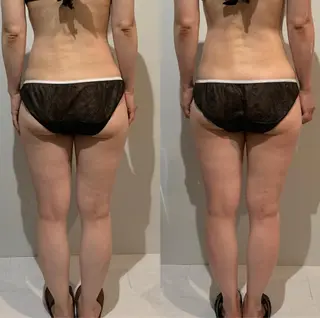 maintenance salon  shinoma所属・ボディメンテナンス shinomaのエステ・リラクイメージ