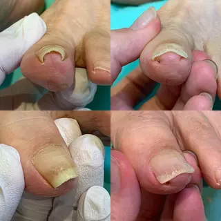 ネイル 東京巻き爪アカデミー所属・東京巻き爪 アカデミーのエステ・リラクイメージ