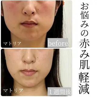 小顔と美肌 まごころエステMatoria所属・小顔 美肌専門 Matoriaのエステ・リラクイメージ