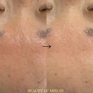 ビューティー ミロワールのエステ・リラクイメージ