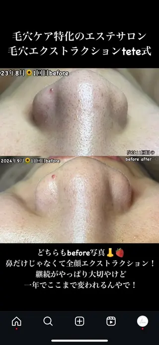 セルフエステエンリケ明石大久保店所属・夕希 毛穴と脱毛特化サロンのエステ・リラクイメージ