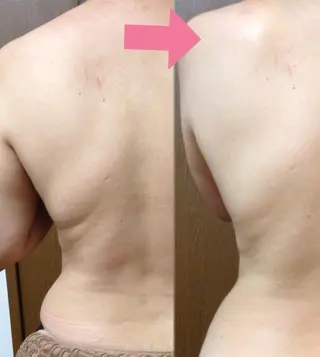 夏までに！ -5kgチャレンジのエステ・リラクイメージ