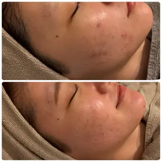 yellow.所属・yellow💛【 脱毛&フェイシャル】のエステ・リラクイメージ