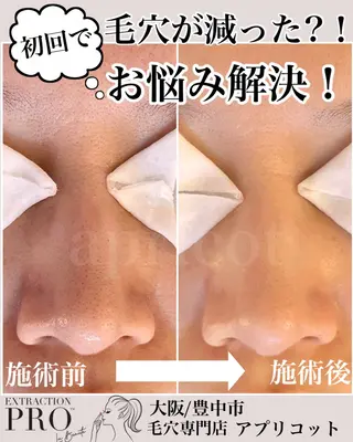 ヘッドスパ専門/豊中 apricotのエステ・リラクイメージ