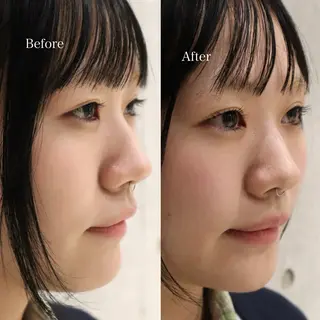 マツエク・マツパ uusi所属・Serena 清澄白河の眉毛・アイブロウイメージ