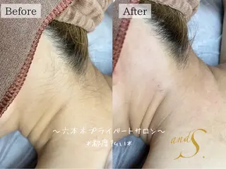 六本木脱毛andS 🍀yuriのエステ・リラクイメージ