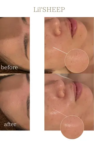 小嶋萌 今池駅徒歩2分のエステ・リラクイメージ