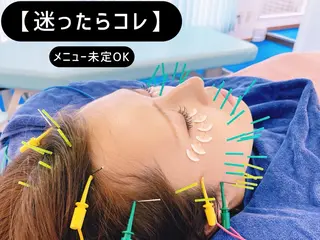 小顔美容鍼専門サロン 渋谷YZのエステ・リラクイメージ