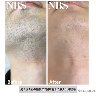 メンズ トータルビューティー サロン　Lisseの眉毛・アイブロウイメージ