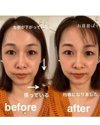 美容鍼灸サロン mahoroba院長のエステ・リラクイメージ