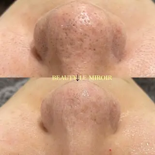 ビューティー ミロワールのエステ・リラクイメージ