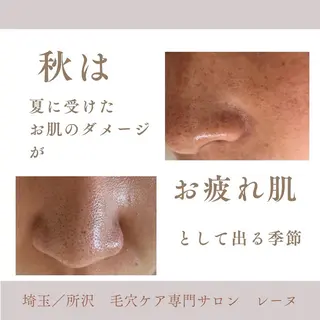 毛穴ケア専門サロン レーヌのエステ・リラクイメージ