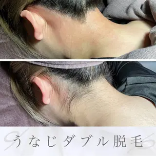 エピナス町田店 ブラジリアンワックスのエステ・リラクイメージ