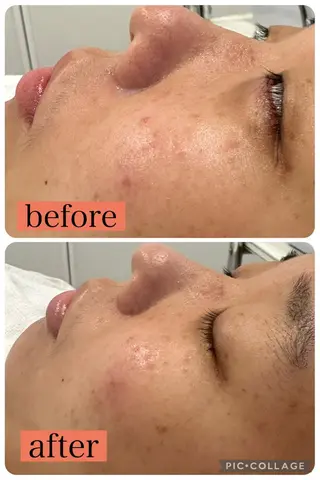 EPIL yuiのエステ・リラクイメージ