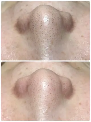 Reir所属・Reir・ SHIORIのマツエク・マツパデザイン