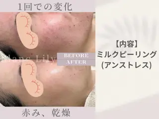 肌質改善サロンBlanc Lily【ブランリリー】所属・パーソナル肌質改善 サロンブランリリーのエステ・リラクイメージ