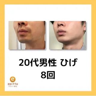 エピット横浜磯子店所属・エピット横浜磯子店 大森のエステ・リラクイメージ