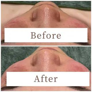 ハーブピーリング専門 muro.のエステ・リラクイメージ