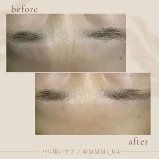 デ・アイム新潟北所属・サイトウ .のエステ・リラクイメージ