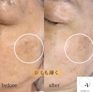 salon eminyのエステ・リラクイメージ