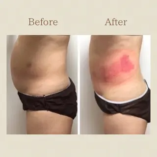 お腹痩せエステ Flat BELLY 恵比寿所属・【腸もみ/冷却痩身】 お腹エステ/恵比寿のエステ・リラクイメージ