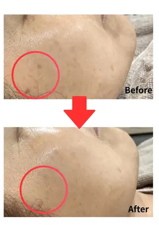 Belle White所属・本格痩身＊透明美肌 BelleWhiteのエステ・リラクイメージ