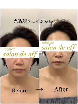 🩵Tatsumi Kana🩵のエステ・リラクイメージ