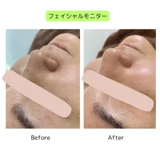 beauty EMELY名古屋のエステ・リラクイメージ