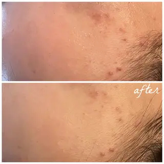 メンズ メナード岐阜市茜部 杉浦のエステ・リラクイメージ