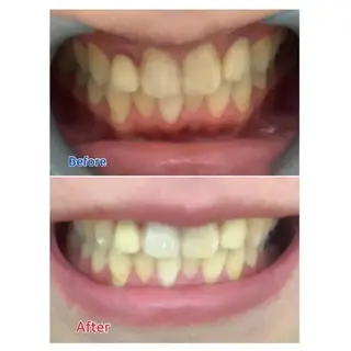 M渋谷店所属・M渋谷 ホワイトニングのエステ・リラクイメージ