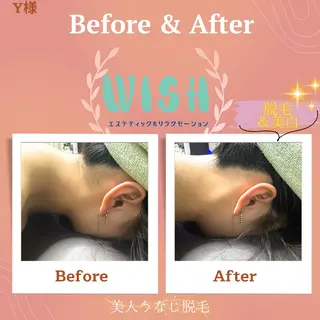 WISH 美肌脱毛のプロ！須藤のエステ・リラクイメージ