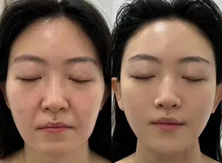 ネイル aliaハイフ&水光ジェットサロン所属・aliaハーブ水光店 エステティシャン募集のエステ・リラクイメージ