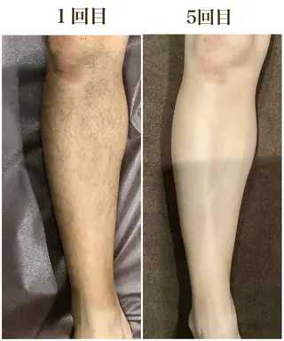 メンズ サロンボーテアネラ燕三条所属・サロンボーテアネラ 燕三条のエステ・リラクイメージ