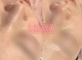 アイラッシュ&エステサロンLinda西宮所属・小顔&毛穴・肌質改善 LINDA西宮 AIのエステ・リラクイメージ