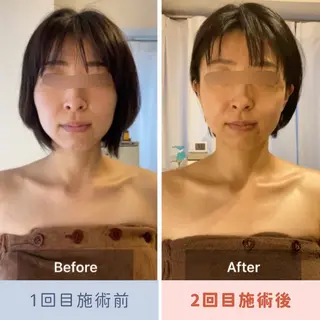 眉毛×小顔矯正サロン パピヨンsakiのエステ・リラクイメージ