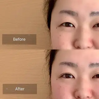 新宿hari-me所属・美容鍼hari-me 新宿のエステ・リラクイメージ