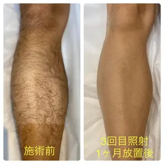 YOLO 梅郷店所属・YOLO痩身/脱毛 🌼MARI🌼のエステ・リラクイメージ